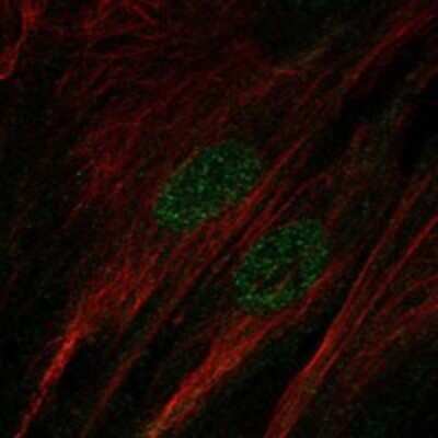 Immunocytochemistry/ Immunofluorescence: SALL1 Antibody [NBP3-17307]