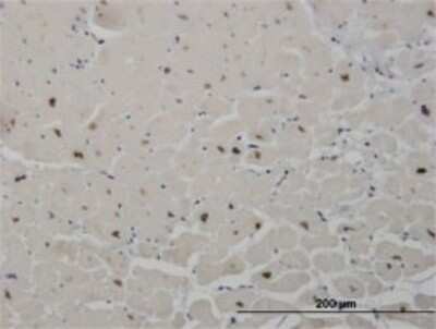 Immunohistochemistry-Paraffin: SALL2 Antibody (3F7) [H00006297-M10]