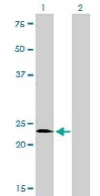 Western Blot: SALL2 Antibody (3F7) [H00006297-M10]