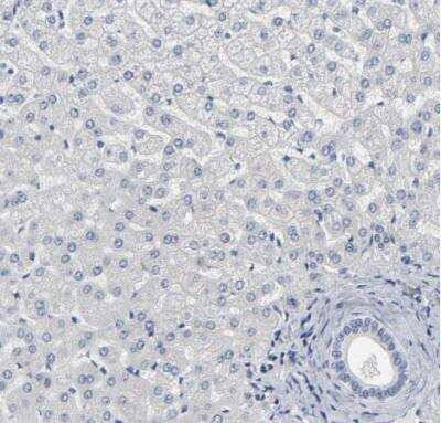 Immunohistochemistry-Paraffin: SALL2 Antibody [NBP2-13276]