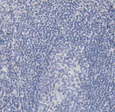 Immunohistochemistry-Paraffin: SALL2 Antibody [NBP2-13276]
