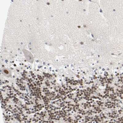 Immunohistochemistry-Paraffin: SALL2 Antibody [NBP2-13276]