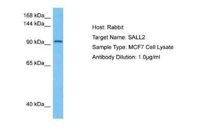 Western Blot: SALL2 Antibody [NBP2-88208]