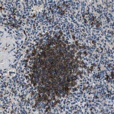 Immunohistochemistry-Paraffin: SALL3 Antibody [NBP1-80587]