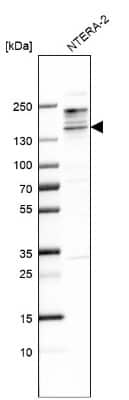 Western Blot: SALL3 Antibody [NBP1-80587]