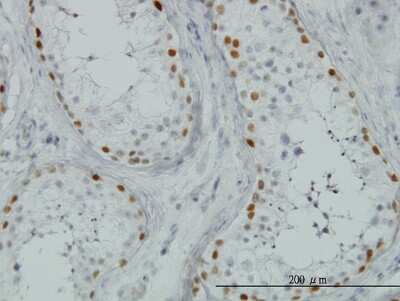 Immunohistochemistry-Paraffin: SALL4 Antibody (6E3) [H00057167-M03]