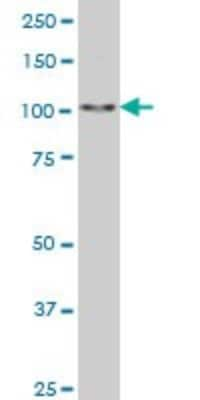 Western Blot: SALL4 Antibody (6E3) [H00057167-M03]