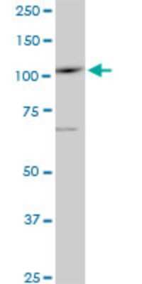 Western Blot: SALL4 Antibody (6E3) [H00057167-M03]
