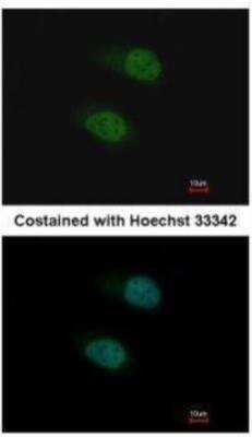 Immunocytochemistry/ Immunofluorescence: SALL4 Antibody [NBP1-32969]