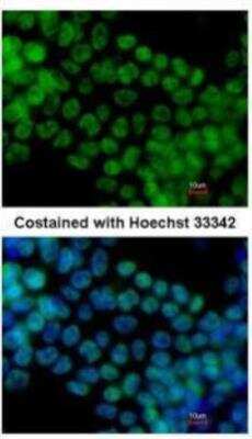 Immunocytochemistry/ Immunofluorescence: SALL4 Antibody [NBP1-32969]