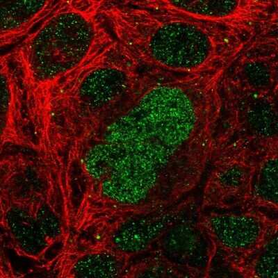 Immunocytochemistry/ Immunofluorescence: SALL4 Antibody [NBP1-84247]