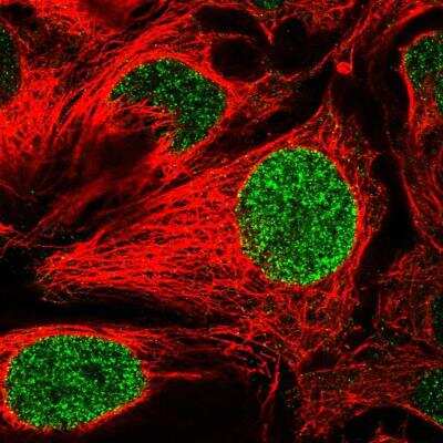 Immunocytochemistry/ Immunofluorescence: SALL4 Antibody [NBP1-85206]