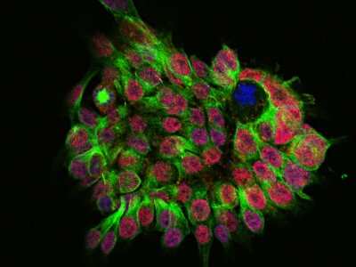 Immunocytochemistry/ Immunofluorescence: SALL4 Antibody [NBP2-98704]