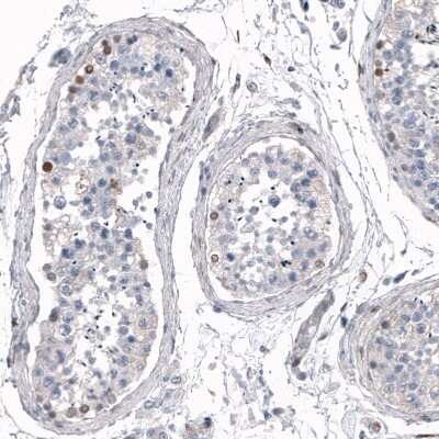 Immunohistochemistry-Paraffin: SALL4 Antibody [NBP1-84247]