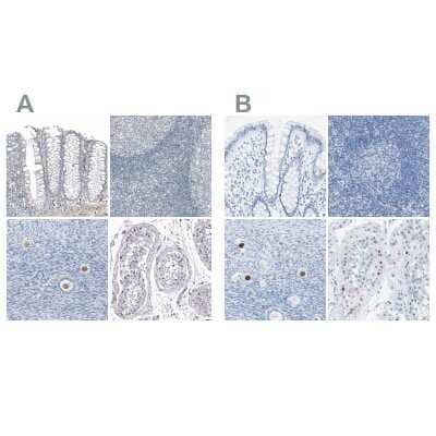 Immunohistochemistry-Paraffin: SALL4 Antibody [NBP1-84247]