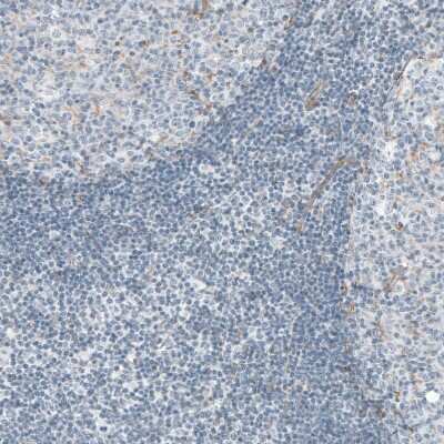 Immunohistochemistry-Paraffin: SALL4 Antibody [NBP1-84247]