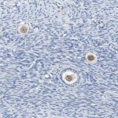 Immunohistochemistry-Paraffin: SALL4 Antibody [NBP1-84247]