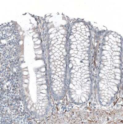 Immunohistochemistry-Paraffin: SALL4 Antibody [NBP1-84247]