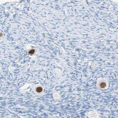 Immunohistochemistry-Paraffin: SALL4 Antibody [NBP1-85206]