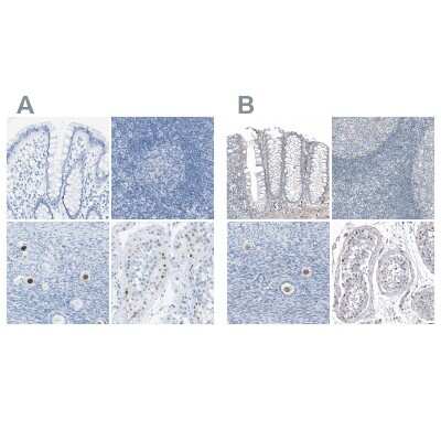 Immunohistochemistry-Paraffin: SALL4 Antibody [NBP1-85206]