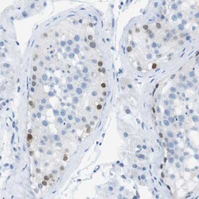 Immunohistochemistry-Paraffin: SALL4 Antibody [NBP1-85206]