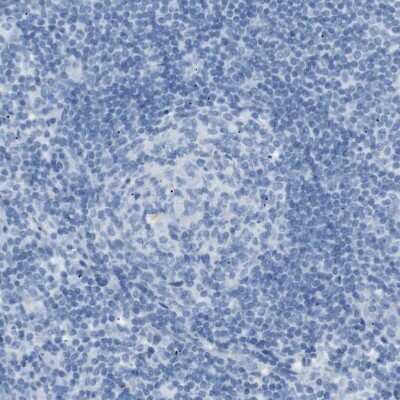 Immunohistochemistry-Paraffin: SALL4 Antibody [NBP1-85206]