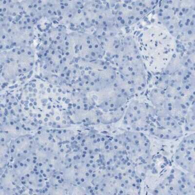 Immunohistochemistry-Paraffin: SALL4 Antibody [NBP1-85206]