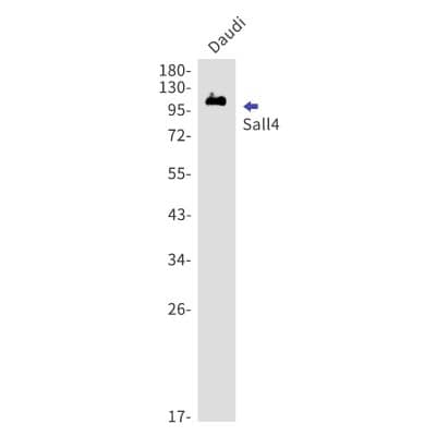 Western Blot: SALL4 Antibody (S02-6H7) [NBP3-19766]