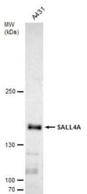 Western Blot: SALL4 Antibody [NBP1-32969]