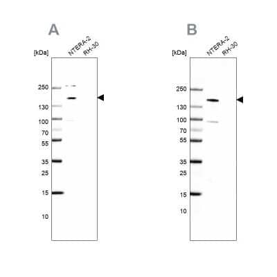 Western Blot: SALL4 Antibody [NBP1-84247]