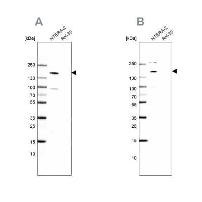 Western Blot: SALL4 Antibody [NBP1-85206]