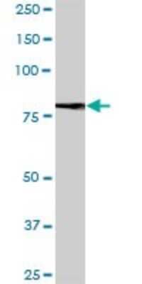 Western Blot: SALM2/LRFN1 Antibody [H00057622-B01P]