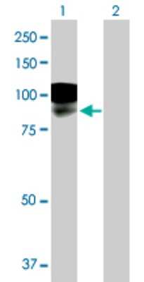 Western Blot: SALM2/LRFN1 Antibody [H00057622-B01P]
