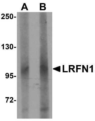 Western Blot: SALM2/LRFN1 AntibodyBSA Free [NBP1-77345]