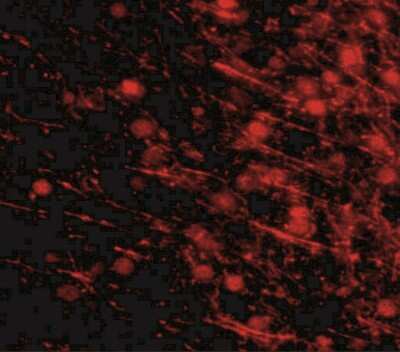 Immunocytochemistry/ Immunofluorescence: SALM3/LRFN4 Antibody - BSA Free [NBP2-41100]