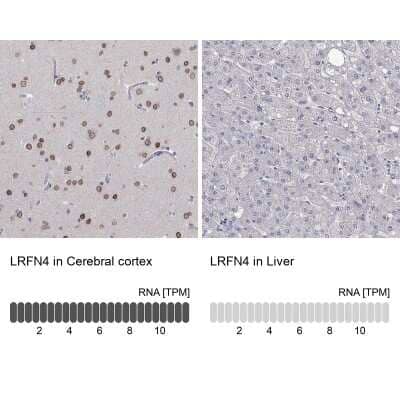 Immunohistochemistry-Paraffin: SALM3/LRFN4 Antibody [NBP3-17090]