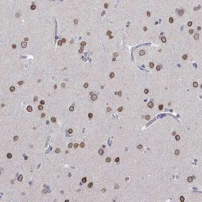 Immunohistochemistry-Paraffin: SALM3/LRFN4 Antibody [NBP3-17090]