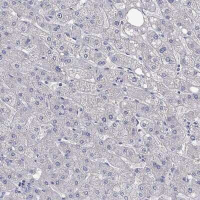 Immunohistochemistry-Paraffin: SALM3/LRFN4 Antibody [NBP3-17090]