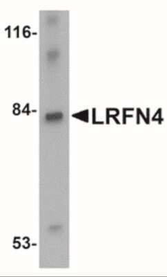 Western Blot: SALM3/LRFN4 AntibodyBSA Free [NBP2-41100]