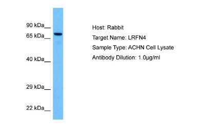 Western Blot: SALM3/LRFN4 Antibody [NBP2-86792]