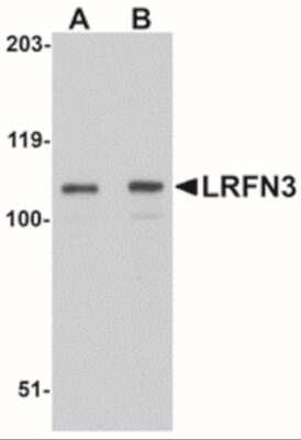 Western Blot: SALM4/LRFN3 AntibodyBSA Free [NBP2-41098]