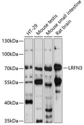 Western Blot: SALM4/LRFN3 AntibodyAzide and BSA Free [NBP2-94020]