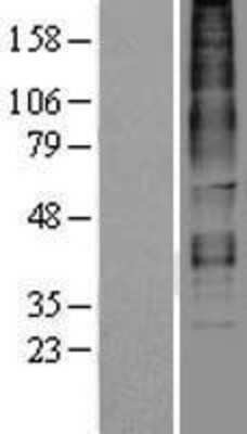 Western Blot: RXFP3/RLN3R1/SALPR Overexpression Lysate [NBP2-04358]