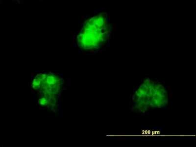 Immunocytochemistry/ Immunofluorescence: SAM68 Antibody (1A4) [H00010657-M03]