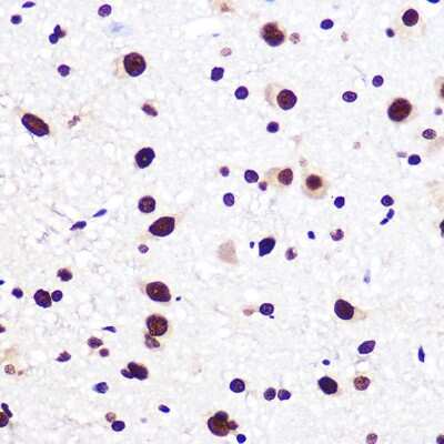 Immunohistochemistry-Paraffin: SAM68 Antibody (1O7D1) [NBP3-16289]