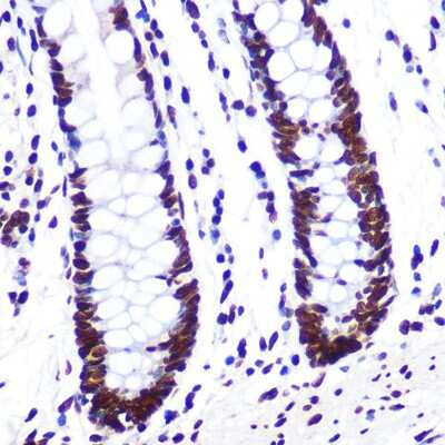 Immunohistochemistry-Paraffin: SAM68 Antibody (1O7D1) [NBP3-16289]