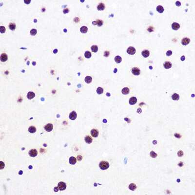 Immunohistochemistry-Paraffin: SAM68 Antibody (1O7D1) [NBP3-16289]