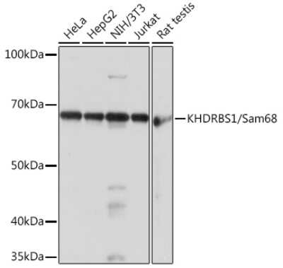 Western Blot: SAM68 Antibody (1O7D1) [NBP3-16289]