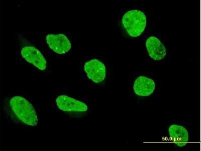 Immunocytochemistry/ Immunofluorescence: SAM68 Antibody [H00010657-B01P]