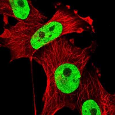 Immunocytochemistry/ Immunofluorescence: SAM68 Antibody [NBP2-38805]